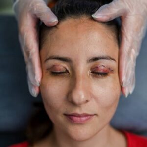 What is the eyelid surgery cost in Pakistan?