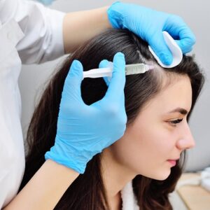 What are the benefits of PRP Hair Treatment?