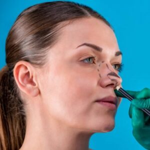 How Much Does a Non-Surgical Nose Job Cost in Pakistan?