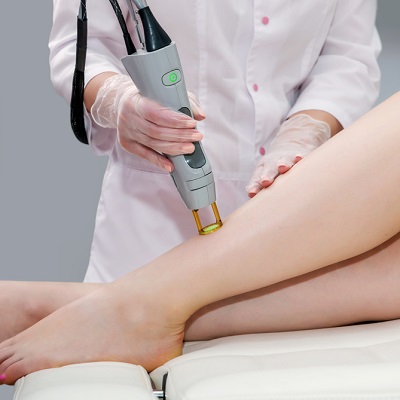 Best Electrolysis Hair Removal in Islamabad