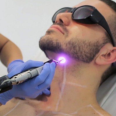 How many laser hair removal must one do for visible results