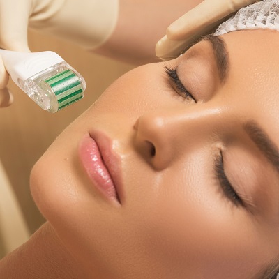 Maximize the Collagen Production Through Microneedling