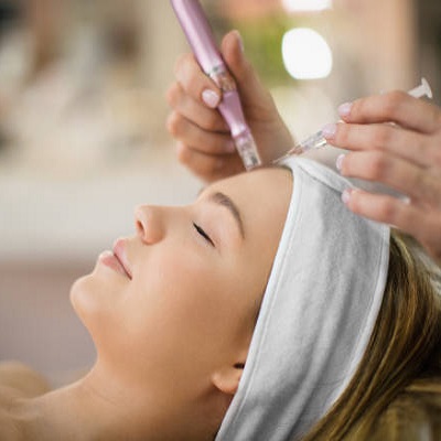 Is Microneedling Good For Acne Scars?