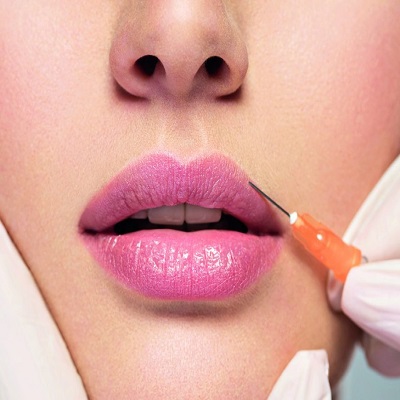 16 Tips to Know Before First-Time Lip Fillers