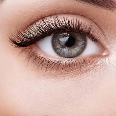 Are eye bags caused by fat?