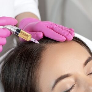Does the Best PRP in Islamabad Regrow Hair Permanently?