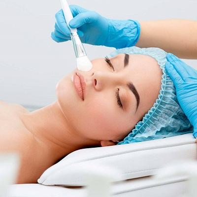 Is Microneedling Better than a Chemical Peel?