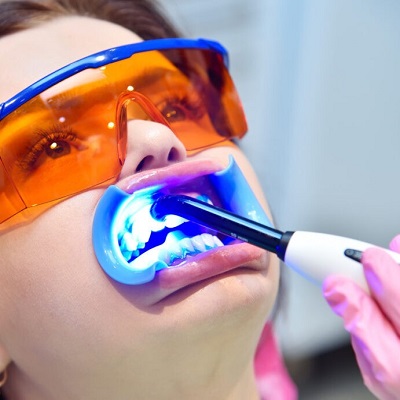 Is the laser teeth whitening safe?