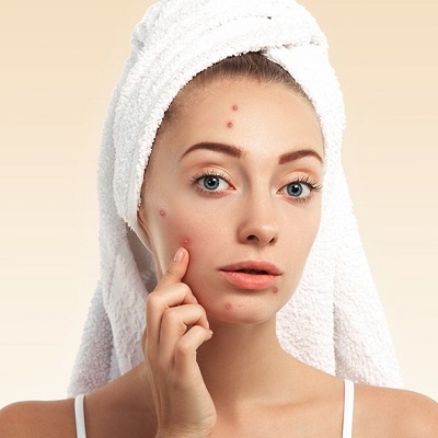 Do I need surgery to get rid of acne scars?