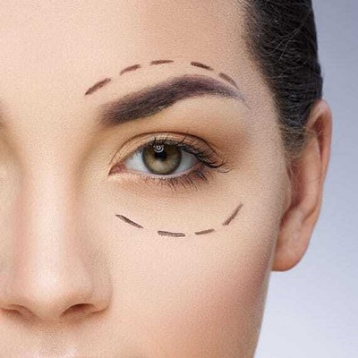 Is It Safe to Use A Computer Screen After Eyelid Surgery?