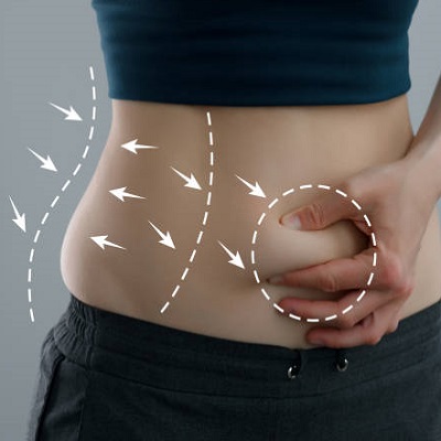 Will A Tummy Tuck Make My Waist Smaller?