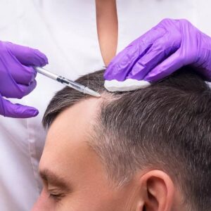 Best Place in Islamabad For PRP Hair Treatment