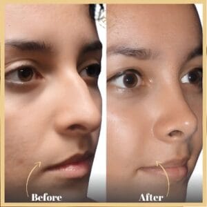 Alarplasty in Islamabad