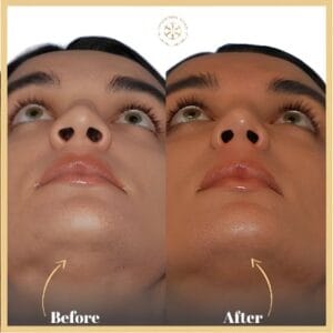 Alarplasty in Islamabad