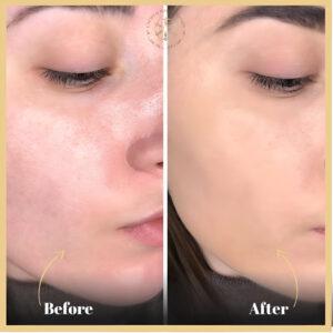 Red Carpet Facial in Islamabad