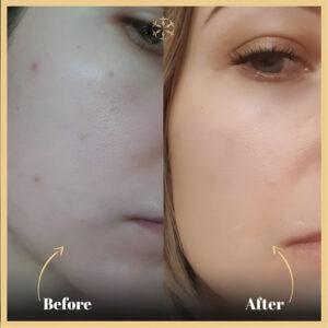 Red Carpet Facial in Islamabad