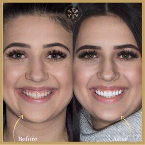 Teeth Scaling in Islamabad