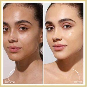 Skin Whitening Treatment before after