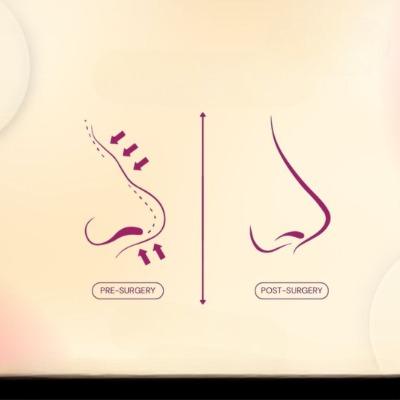 Who Performs Alarplasty at Islamabad